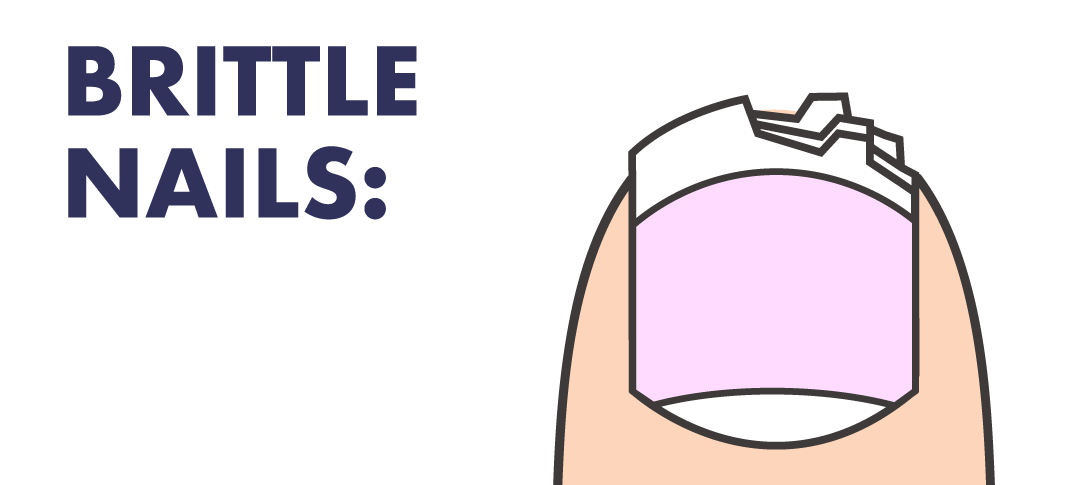 二枚爪の原因は「水」!?